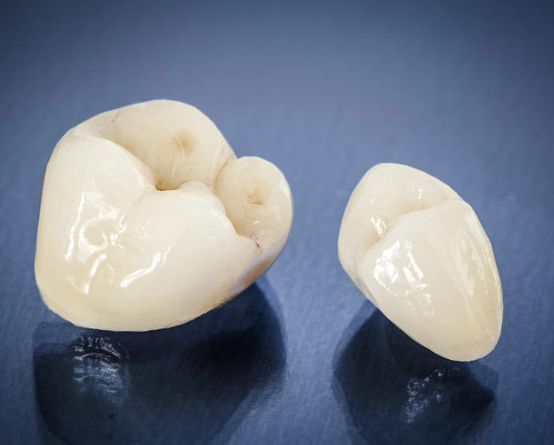 Dentaly - High-Quality Dental Care Abroad