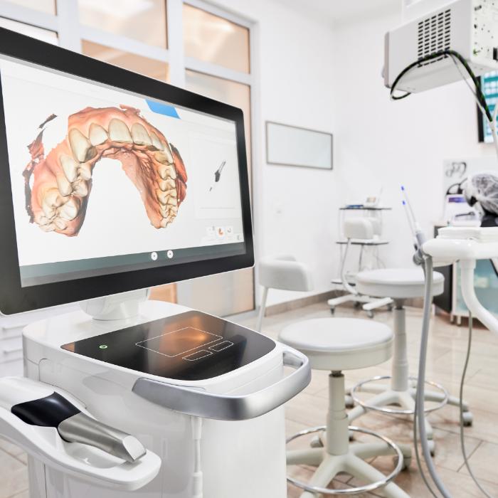 A modern dental clinic equipped with advanced digital technology, featuring a 3D dental scanner displaying a digital impression of a patient's teeth on a computer screen. The setup includes dental stools, instruments, and a clean, sterile environment.