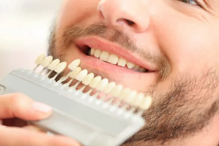 A close-up of a smiling man with a shade guide held near his teeth, used for selecting the perfect color match for veneers or teeth whitening treatments.
