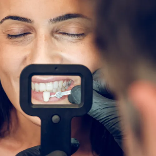 dentaly