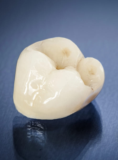Dental Crowns